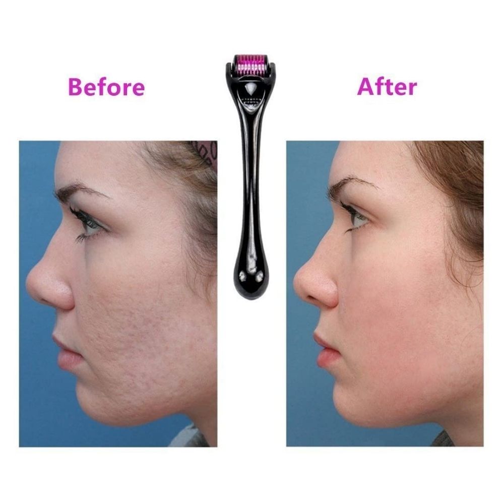 Derma Roller Micro Aguja Piel Perfecta
