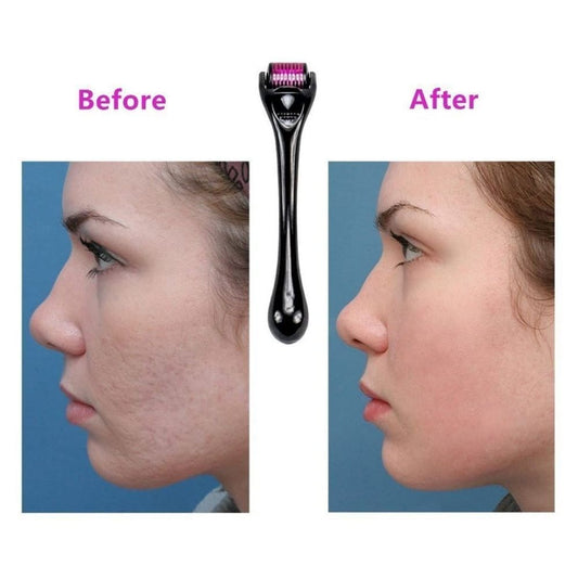 Derma Roller Micro Aguja Piel Perfecta
